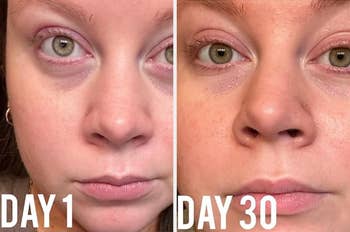 41 Affordable Products With Results That Are So Dang Impressive, You’ll Be Triple-Checking The Price — image 12