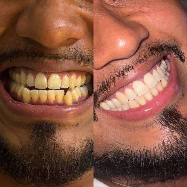 41 Affordable Products With Results That Are So Dang Impressive, You’ll Be Triple-Checking The Price — image 18